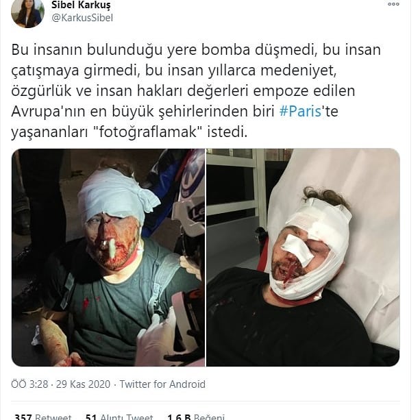 Google Twitter ikilisinin kullandığı yapay zeka, bakın ne yaptı