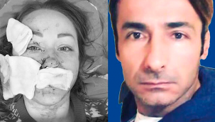Boşanmak isteyen eşinin yüzünü AVM'de falçatayla parçaladı