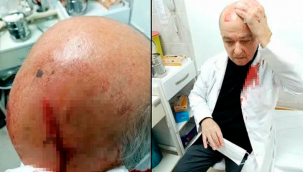 İzmir'de maske uyarısı yapan doktor taşlı saldırıya uğradı