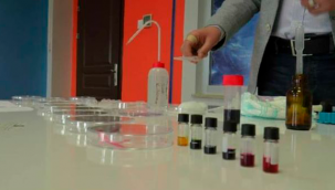 Üriner sistem enfeksiyonlarının tespitinde yerli ve milli