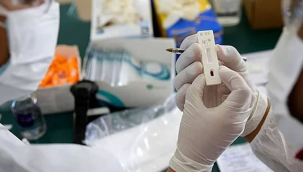 Oxford Üniversitesi 57 Bin Lira Karşılığında Yeniden Koronavirüs'e yakalanmayı kabul edecek gönüllüler arıyor