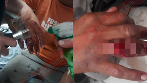 Kayseri'de parmağı yüzüğe sıkışan şahsı itfaiye kurtardı