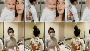 Konya'da eşi ile çocuğunu kaynar suyla yakan ve