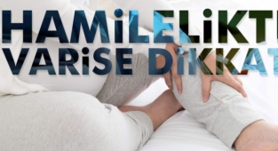 Hamilelikte varis gelişimine dikkat