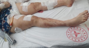 İstanbul’da koca dehşeti: Kucağına çocuğunu alıp eşine 12 el ateş etti