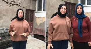 İş kazasında kollarını kaybeden Sevim Nur, biyonik kollarına kavuştu!