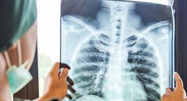 Yaz ayları geldi vakalar arttı: Türkiye'de yeni salgın alarmı