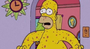 Maymun Çiçeği virüsünde Simpsonlar detayı! Yine bildler