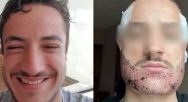 Türkiye’de bir emlakçıya sakal ekimi yaptıran Fransız öğrenci intihar etti