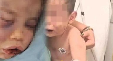 Denizli'de vahşet! 2 yaşındaki bebeği darp etti, gözaltına alındı