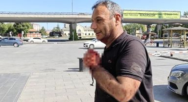 Kayseri'de acemi kasaplar soluğu acil serviste aldı