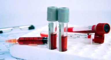 Sağlık Bakanlığı’ndan Yeni Test Kısıtlaması: Hekimler Tepkili