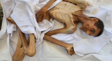 Gazze'de Açlık Bir Can Daha Aldı: 27 Yaşındaki Adil 15 Kiloya Düşerek Hayatını Kaybetti