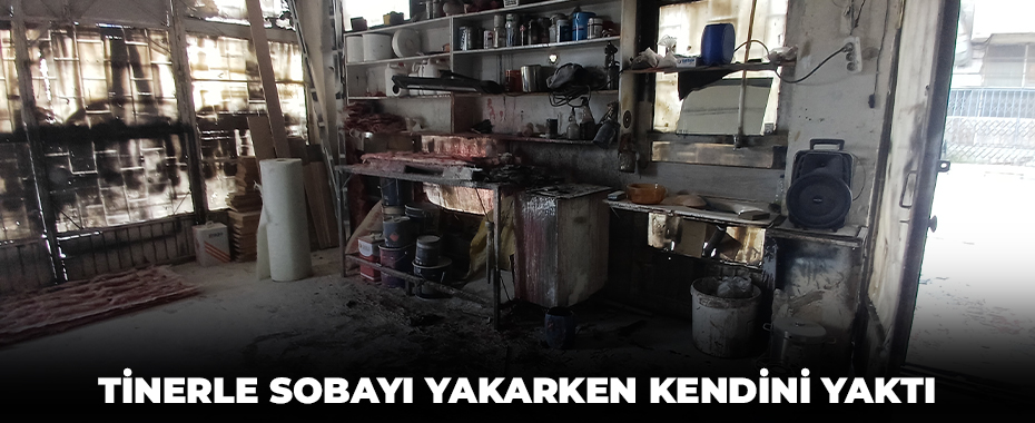 Tinerle sobayı yakarken kendini yaktı