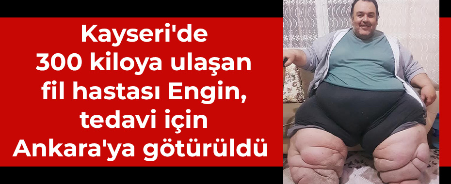 Kayseri'de 300 kiloya ulaşan fil hastası Engin, tedavi için Ankara'ya götürüldü