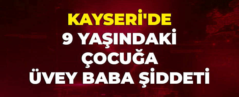Kayseri'de 9 yaşındaki çocuğa üvey baba şiddeti