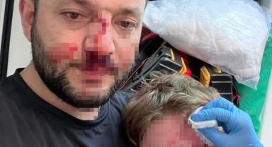 Yalova'da komşuların gürültü kavgasında 14 aylık bebek hastanelik oldu