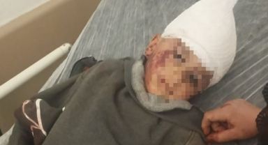 3 yaşındaki çocuğuna köpek saldıran baba: